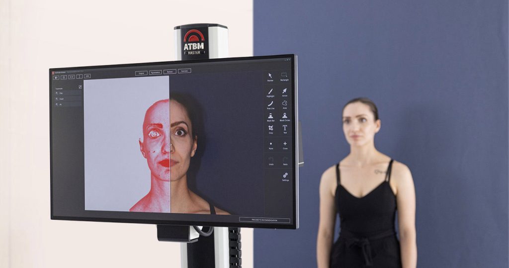 Pohled na monitor přístroje FotoFinder