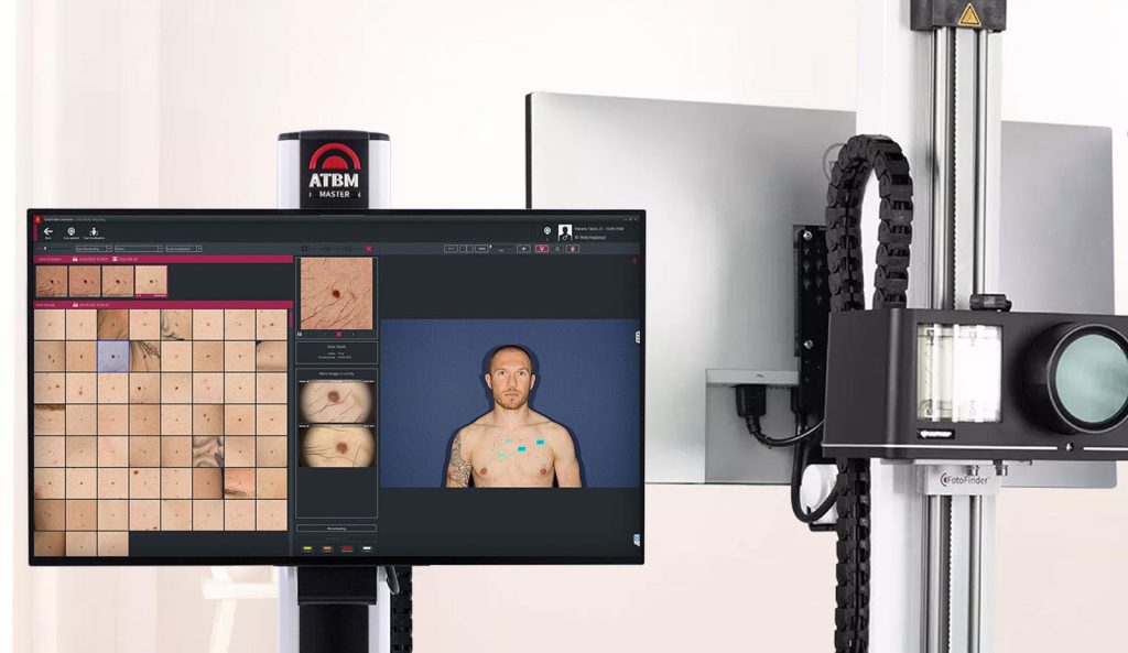 Pohled na přístroj FotoFinder